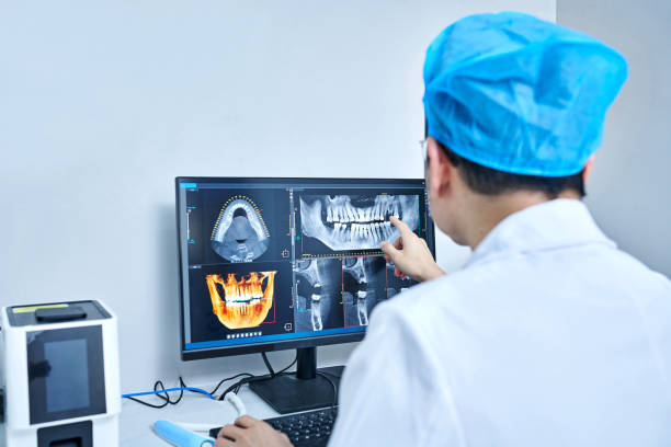 Best Emergency Dentist for Lost Fillings or Crowns in Eureka, MO
