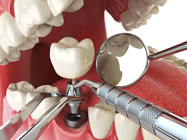 Best Emergency Dental Services for Seniors in Eureka, MO
